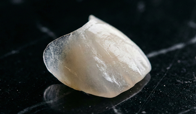 Garantia de 10 Anos - Proteção Total